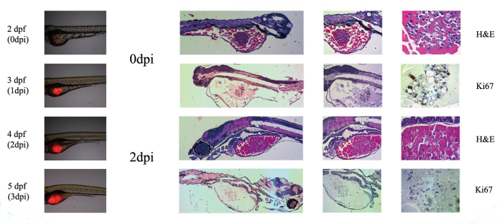 zPDX模型预测肿瘤免疫疗效